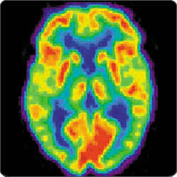 brain